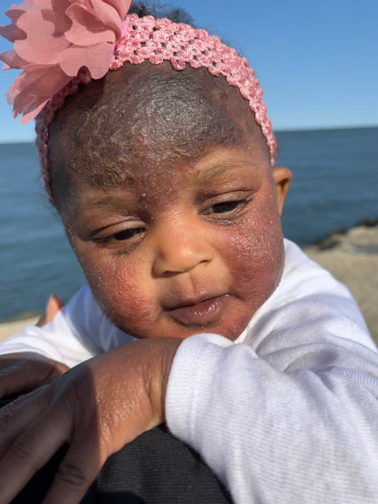 JUSTICE FOR KIONI (Fundraiser)